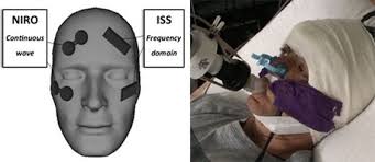 NIRS position and DEF illustrated