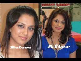 Another one of the reasons for hair loss after birth control is inflammation. Hair Loss Products And Tips Youtube