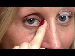 More images for how to clean baby eyes and clogged tear duct » How To Clean Baby S Eyes And Clogged Tear Ducts Youtube
