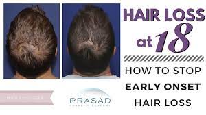 It usually occurs gradually and in predictable patterns — a receding hairline and bald spots in men and thinning hair along the crown of the scalp in women. Hair Loss At 18 A Better Treatment For Early Onset Hair Loss Than Prp Alone Youtube