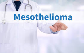 And, the risk increases with age. Mesothelioma Compensation Mesotheliomahelp Org