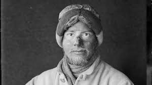 Frost Bite: When Sub-Zero Temperatures Shattered an Antarctic Explorer's  Teeth