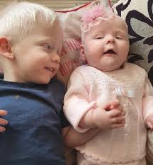 Mum begs for strangers to stop 'rude and nasty' remarks about her children  with rare condition