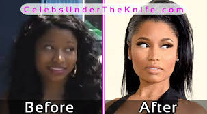 Miami has already sent shots . Nicki Minaj Before Photos After Plastic Surgery