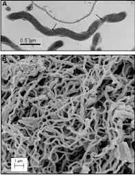 Electron microscopic analysis of T. denticola . Transmission (A) and... |  Download Scientific Diagram