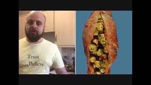 În multe cazuri, pietrele la fiere nu dau simptome și pot fi depistate doar în urma unei ecografii. Eliminarea Pietrelor Din Fiere Fara Operatie Youtube