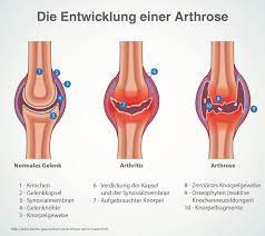 Hunde, die an arthrose leiden, zeigen nach und nach eine vermehrte bewegungsunlust. Arthrose Beim Hund Symptome Behandlung