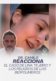 En este video, el Dr. Camilo Guerrero analiza el caso de Lina Tejeiro,  reconocida actriz colombiana que sufrió complicaciones de salud a raíz de  la aplicación de biopolímeros en sus glúteos años ...