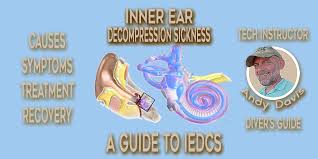 Image result for Decompression Sickness