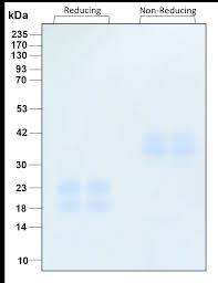 Image result for CSF Protein