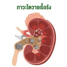 ในชีวิตกันมาบ้างไม่หนักก็เบา ไม่ว่าจะพังในเรื่องการเรียน การงาน ความรัก หรือแม้แต่ใช้ชีวิตประมาทเกินไป. à¸­à¸¢ à¸²à¸¡à¸­à¸‡à¸‚ à¸²à¸¡à¹‚à¸£à¸„à¹„à¸•à¹ƒà¸™à¸ª à¸•à¸§ à¹€à¸¥ à¸¢à¸‡ Best Equipment Center Co Ltd Bec
