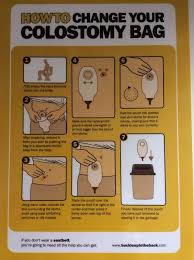 Safety Card Colostomy Bag Colostomy Bag Colostomy Ostomy Care