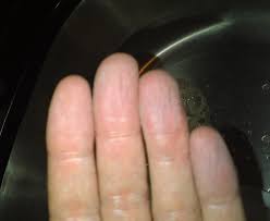 Schrumpelfinger Sind Evolutionare Anpassungssache Geograffitico