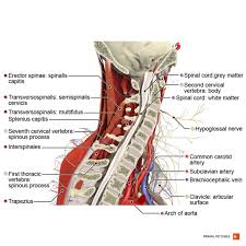 Cervical Radiculopathy Physiopedia