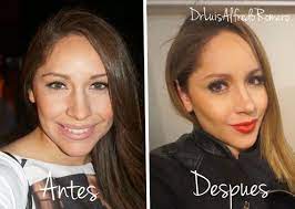 Bichectomy is surgery to reduce fat deposits on the cheeks. Pin On Before And After