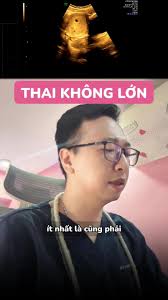 Túi Thai 7mm Là Bao Nhiêu Tuần