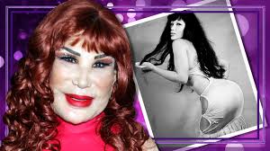 Check spelling or type a new query. Lyn May Asi Era Su Rostro Antes De Los Fallidos Tratamientos Esteticos