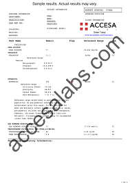 Testosteron, cortisol, serotonin, östrogen & melatonin. Hormone Test Near You Blood Test For Hormones Accesa Labs