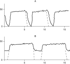 The easycap directions for use which are directly relevant to the events reported by the facility are as follows: Respiratory Gas Monitoring Chapter 14 Monitoring In Anesthesia And Perioperative Care
