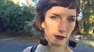 Fundraiser by Basil Stevens : Help Basil Janie afford 3 surgeries in 1 year