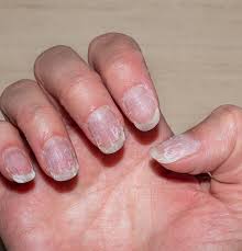 Rough Nail Surface