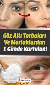 Goz Alti Torbalari Ve Morluklardan Bir Gunde Kurtulmak Ister Misiniz Cilt Bakimi Dogal Cilt Bakimi Dogal Cilt