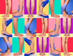 1 es una forma de trombosis venosa que usualmente afecta las venas en la parte inferior de la pierna y el muslo, como la vena femoral o la vena poplítea, o las venas profundas de la pelvis. Clasificacion De La Trombosis