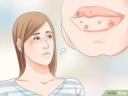 Image result for syphilis symptoms