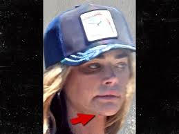 Denise Richards Sports Apparent Black Eye Days After Showing Up at  Estranged Husband's House