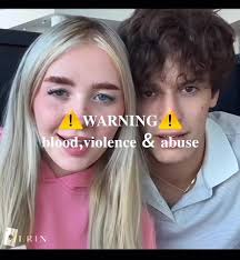 #kaylamalecc #xcyzba #fyp #help #abusiverelationship #kayla #jaw #you  #brokenheart #broke #broken #my #jaw