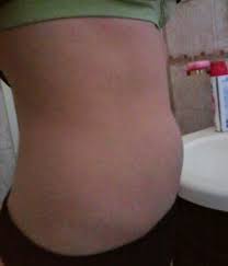 Estoy De 14 Semanas Y No Tengo Panza Club Diciembre 2019 Embarazo Y Bebes Babycenter