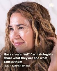 The world has lost a fashion icon. Designer and fashion icon Iris Apfel has  died at the age of 102. The designer's verified Instagram account shared  the news