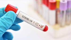 Number of covid deaths claimed by them in the period is a fraction of excess deaths and this is not even the largest state population wise. Norway Requires Negative Pcr Test Results For Citizens Of High Risk Countries Schengenvisainfo Com