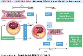 Pin By Andres Sanchez On Cardiology Thrombosis Vascular Learning
