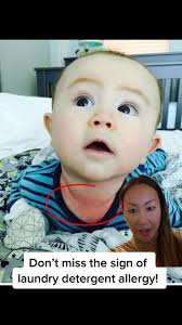 #greenscreen don’t miss the sign of laundry detergent allergy. My son  started having rash at first only the neck area. I didn’t know what it was  and it got worse and worse and finally got diagnosed as ...