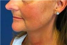 Mariam Awada, MD, FACS