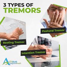 Image result for Rest Tremor