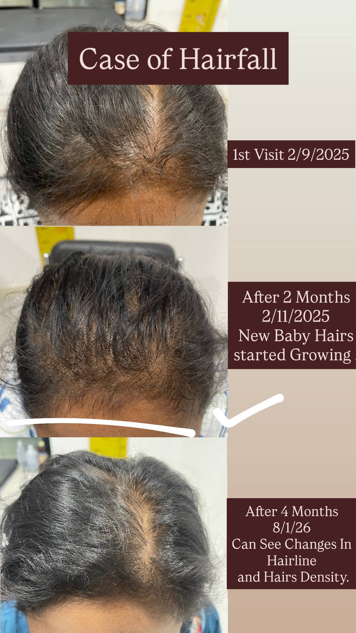 Hairfall treatment product image