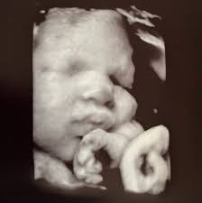 Remembering Aubrey Boyd-Snee