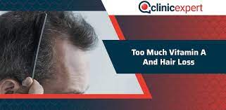 In order to prevent toxicity of vitamin a, you should increase your protein intake by eating meat, fish, eggs and dairy products. Too Much Vitamin A And Hair Loss Clinicexpert International