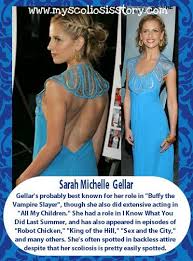 Pin By Saymariiee On Wish I Was Straight Scoliosis Exercises Scoliosis Scoliosis Surgery