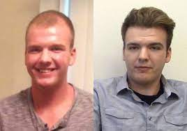 It tends to be more time consuming than strip surgery, but does not leave the obvious and typical scars that strip surgery does. Video Approach For Young Men Experiencing Hair Loss Hair Transplant Case Study Mcgrath Medical