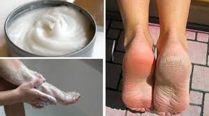 Voici Comment Faire Une Pedicure A La Maison Avec Du Bicarbonate De Soude Toutes Recettes En 2020 Pedicure A La Maison Bicarbonate De Soude Bicarbonate