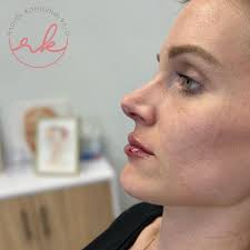 Rachel Komornik PA-C Aesthetics