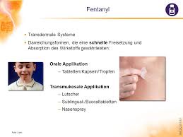 Compositions fur use in the method are also disclosed. Rationelle Schmerztherapie Ppt Herunterladen