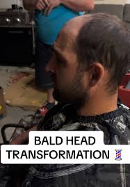 Bald Head Transformation: Hairstyle and Grooming Tips