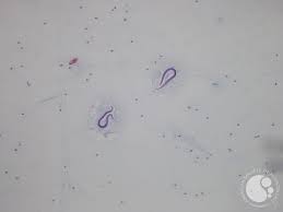 Image result for Strongyloides