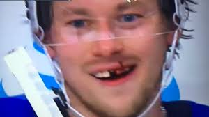 Ovechkin home hockey player teeth alex ovechkin funny memes alex ovechkin games alex ovechkin celebrating alexander ovechkin house alex ovechkin curve alex ovechkin hits next. Congratulations Your Tarasenko Evolved Into Ovechkin Stlouisblues