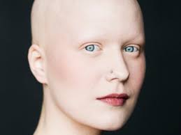 When it comes to men and hair loss, mpb is a term used frequently, and it's also known as androgenic or androgenetic alopecia. Hair Hair Loss 101