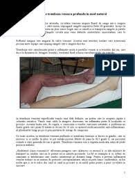 Phlegmasia alba dolens şi phlegmasia cerulea sunt două forme clinice de. Scapa De Tromboza Venoasa Profunda In Mod Natural